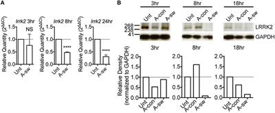 Leucine-Rich Repeat Kinase 2 Controls the Ca2+/Nuclear Factor of Activated T Cells/IL-2 Pathway during Aspergillus Non-Canonical Autophagy in Dendritic Cells